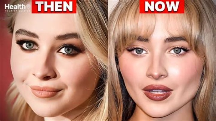 Has Sabrina Carpenter Had Surgery? Truth About Her Plastic Surgery Rumors