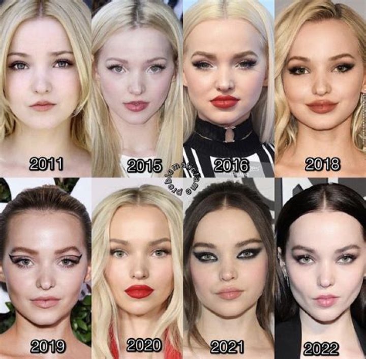 Sabrina Carpenter's Natural Beauty: A Look At Her Transformation Without Plastic Surgery